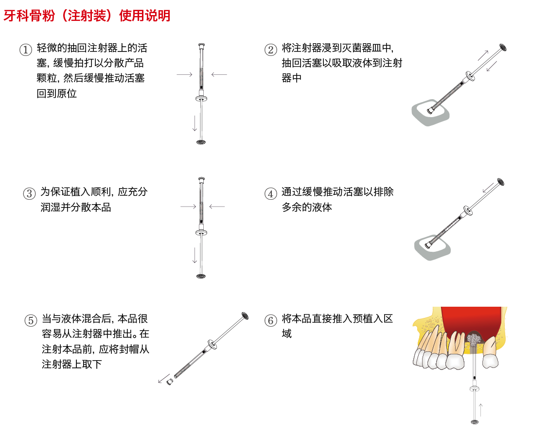 注射装骨粉_画板 1.png